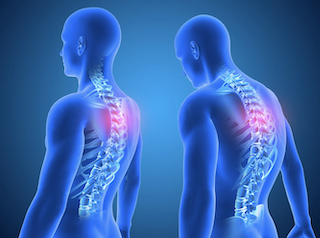 アスリートのための姿勢改善プロトコル