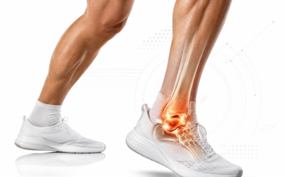 アスリートの足関節 変形性関節炎症（Ankle Osteoarthritis）